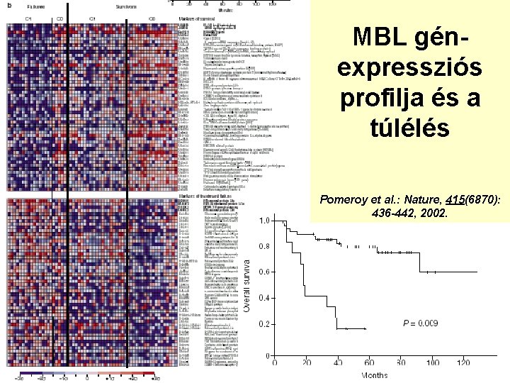 MBL génexpressziós profilja és a túlélés Pomeroy et al. : Nature, 415(6870): 436 -442,