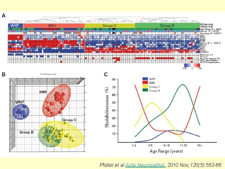 Pfister et al. Acta Neuropathol. 2010 Nov; 120(5): 553 -66. 
