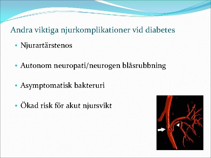 Andra viktiga njurkomplikationer vid diabetes • Njurartärstenos • Autonom neuropati/neurogen blåsrubbning • Asymptomatisk bakteruri