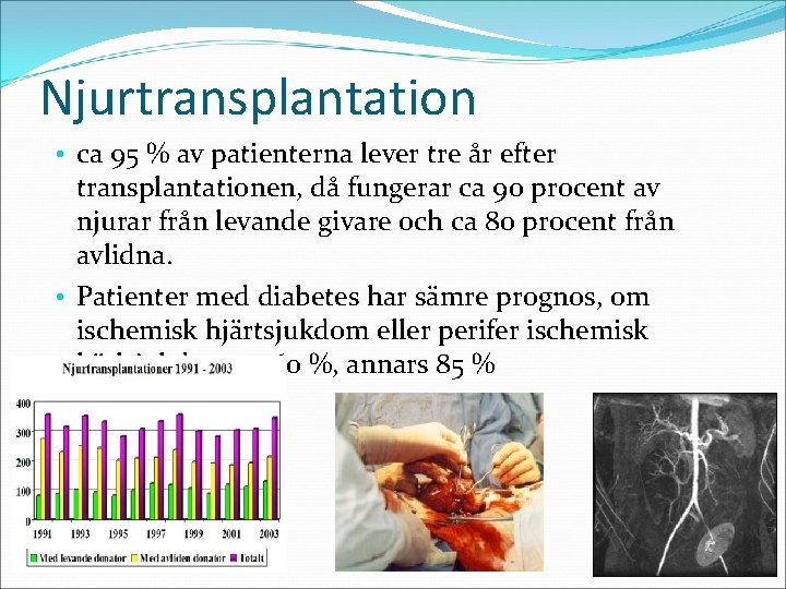 Njurtransplantation • ca 95 % av patienterna lever tre år efter transplantationen, då fungerar