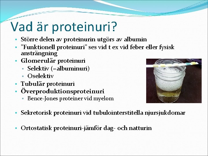 Vad är proteinuri? • Större delen av proteinurin utgörs av albumin • ”Funktionell proteinuri”