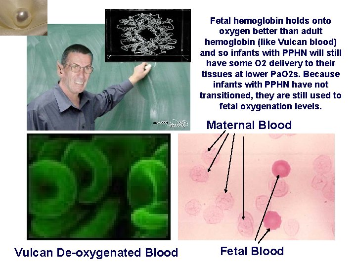 Fetal hemoglobin holds onto oxygen better than adult hemoglobin (like Vulcan blood) and so