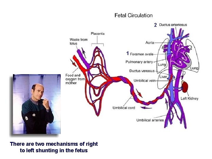 2 1 There are two mechanisms of right to left shunting in the fetus