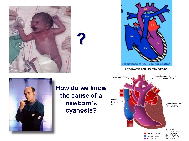 ? How do we know the cause of a newborn’s cyanosis? 