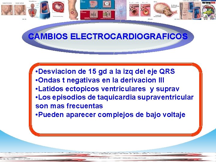 Diagram CAMBIOS ELECTROCARDIOGRAFICOS • Desviacion de 15 gd a la izq del eje QRS