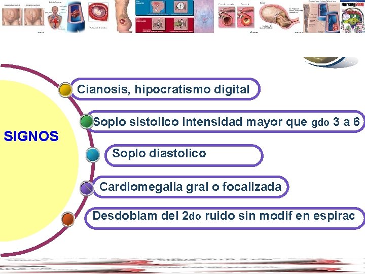 Contents www. thmemgallery. com Cianosis, hipocratismo digital SIGNOS Soplo sistolico intensidad mayor que gdo