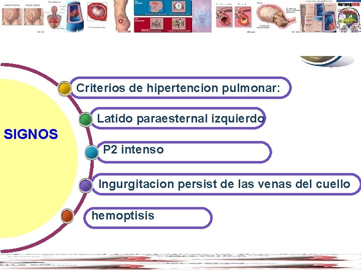 Contents www. thmemgallery. com Criterios de hipertencion pulmonar: Latido paraesternal izquierdo SIGNOS P 2