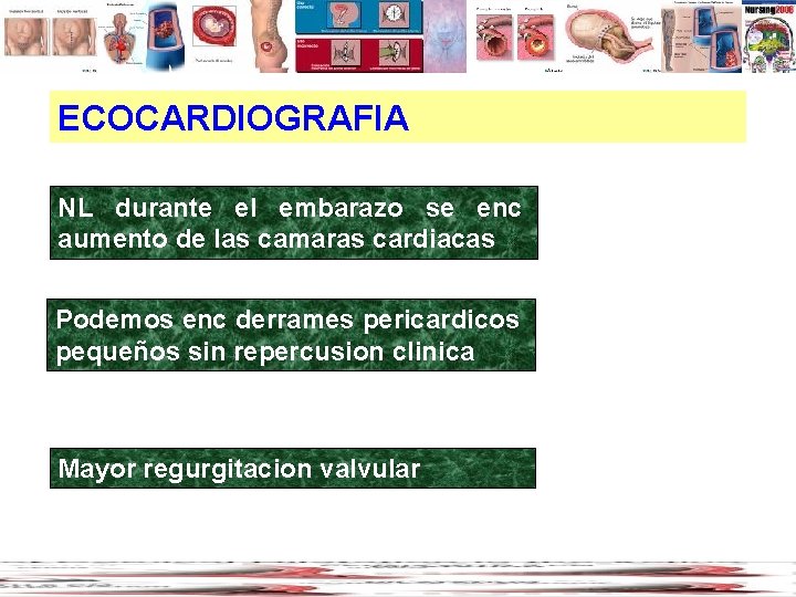 ECOCARDIOGRAFIA NL durante el embarazo se enc aumento de las camaras cardiacas Podemos enc