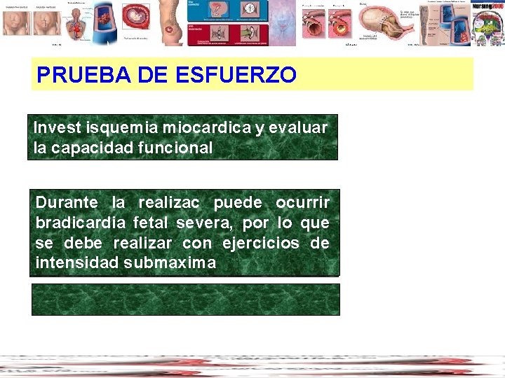 PRUEBA DE ESFUERZO Invest isquemia miocardica y evaluar la capacidad funcional Durante la realizac