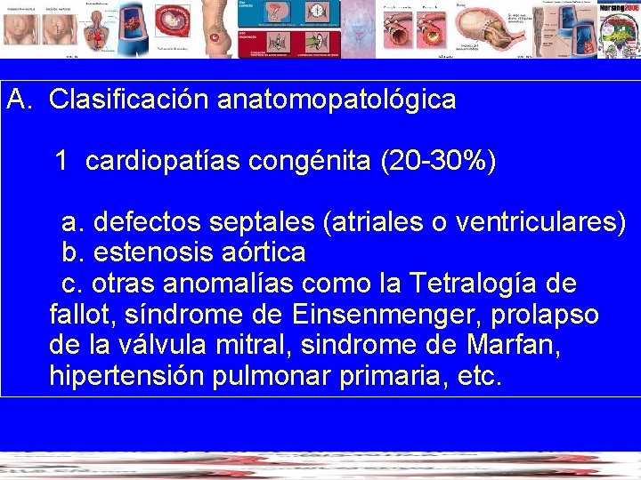 A. Clasificación anatomopatológica 1 cardiopatías congénita (20 -30%) a. defectos septales (atriales o ventriculares)