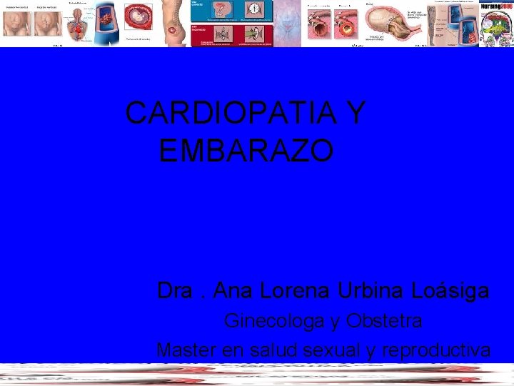 CARDIOPATIA Y EMBARAZO Dra. Ana Lorena Urbina Loásiga Ginecologa y Obstetra Master en salud