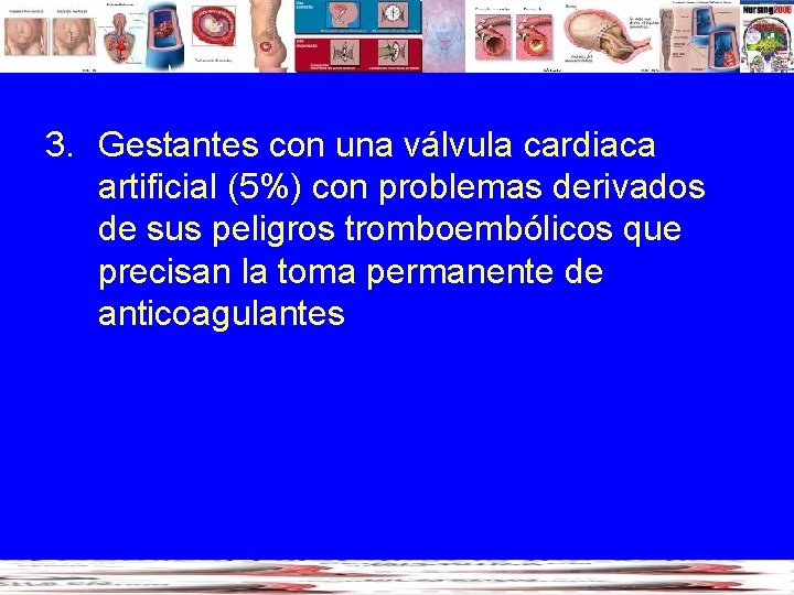 3. Gestantes con una válvula cardiaca artificial (5%) con problemas derivados de sus peligros