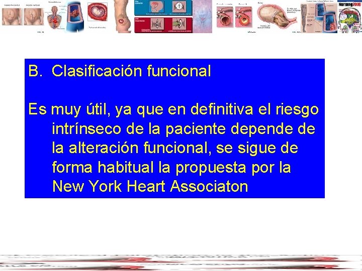B. Clasificación funcional Es muy útil, ya que en definitiva el riesgo intrínseco de