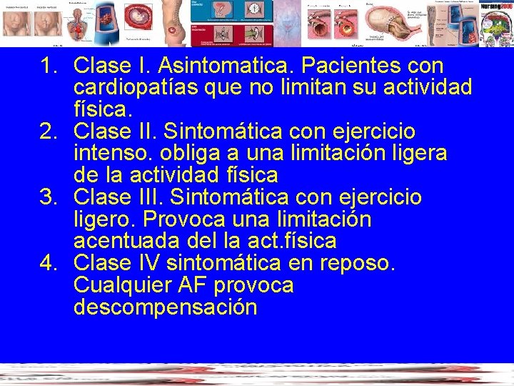 1. Clase I. Asintomatica. Pacientes con cardiopatías que no limitan su actividad física. 2.