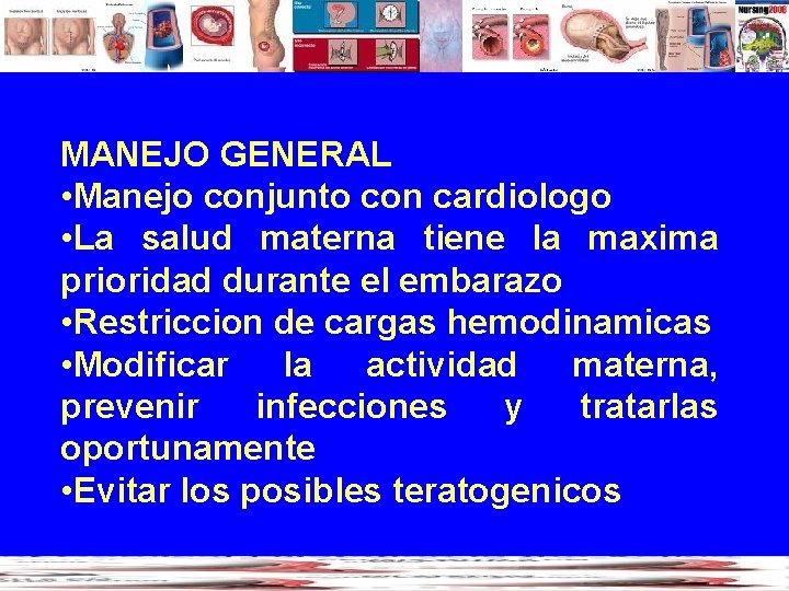 MANEJO GENERAL • Manejo conjunto con cardiologo • La salud materna tiene la maxima