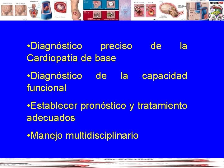  • Diagnóstico preciso Cardiopatía de base • Diagnóstico funcional de la capacidad •