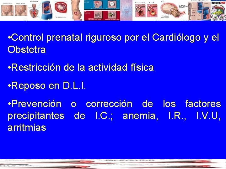  • Control prenatal riguroso por el Cardiólogo y el Obstetra • Restricción de