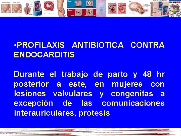  • PROFILAXIS ANTIBIOTICA CONTRA ENDOCARDITIS Durante el trabajo de parto y 48 hr