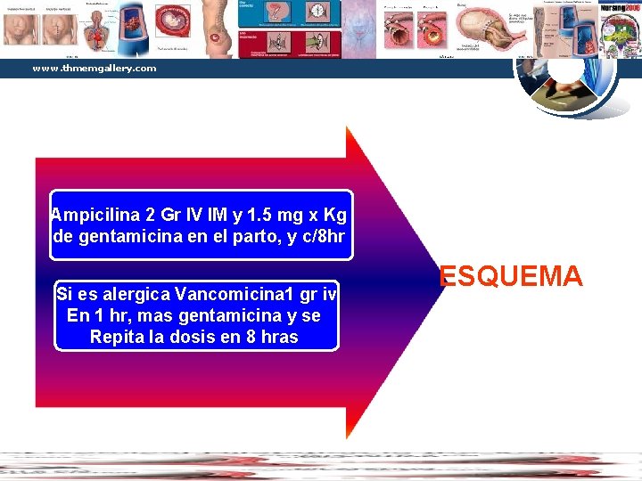 Diagram www. thmemgallery. com Ampicilina 2 Gr IV IM y 1. 5 mg x