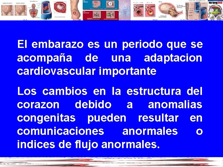 El embarazo es un periodo que se acompaña de una adaptacion cardiovascular importante Los
