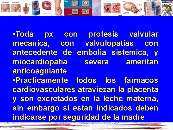  • Toda px con protesis valvular mecanica, con valvulopatias con antecedente de embolia