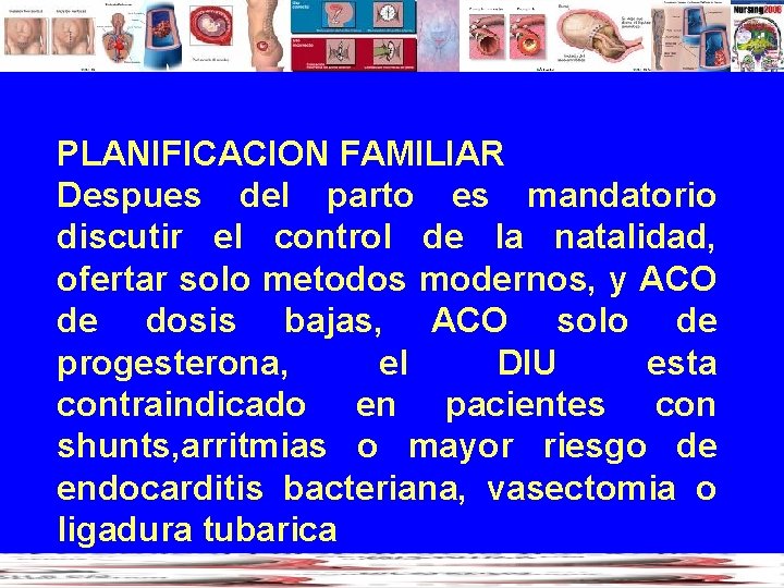 PLANIFICACION FAMILIAR Despues del parto es mandatorio discutir el control de la natalidad, ofertar