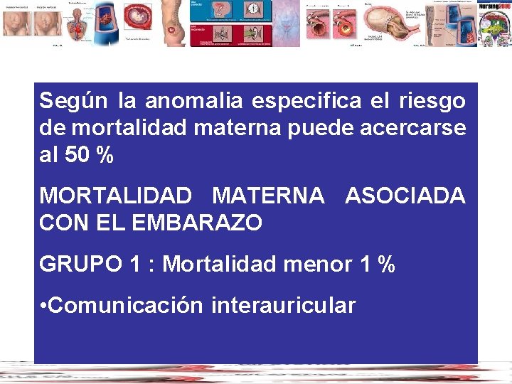 Según la anomalia especifica el riesgo de mortalidad materna puede acercarse al 50 %