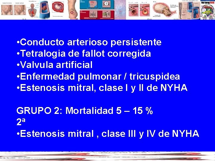  • Conducto arterioso persistente • Tetralogia de fallot corregida • Valvula artificial •