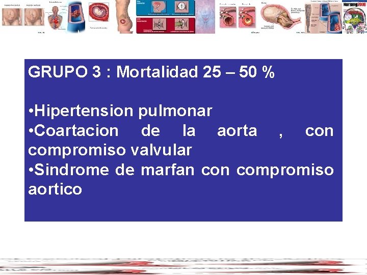 GRUPO 3 : Mortalidad 25 – 50 % • Hipertension pulmonar • Coartacion de