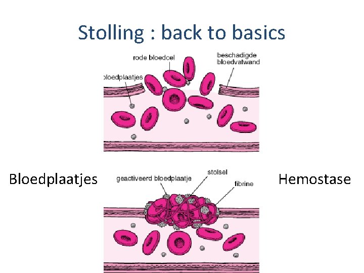 Stolling : back to basics Bloedplaatjes Hemostase 