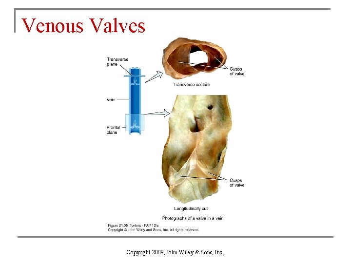 Venous Valves Copyright 2009, John Wiley & Sons, Inc. 