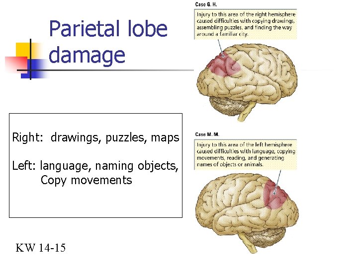 Parietal lobe damage Right: drawings, puzzles, maps Left: language, naming objects, Copy movements KW