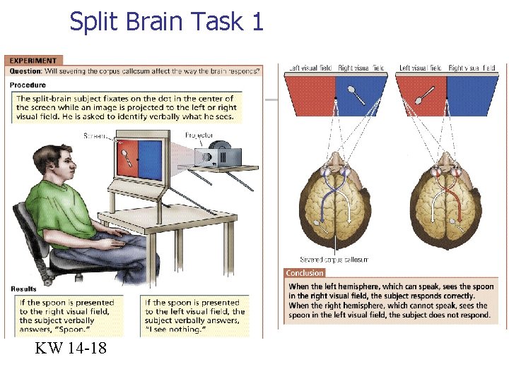 Split Brain Task 1 KW 14 -18 