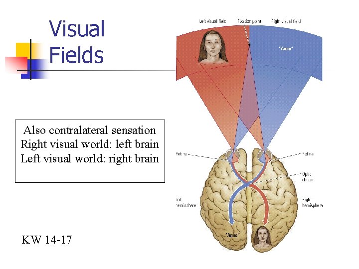 Visual Fields Also contralateral sensation Right visual world: left brain Left visual world: right