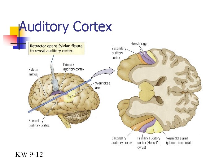 Auditory Cortex KW 9 -12 