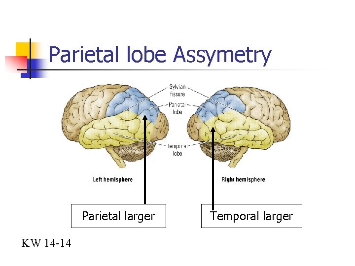 Parietal lobe Assymetry Parietal larger KW 14 -14 Temporal larger 