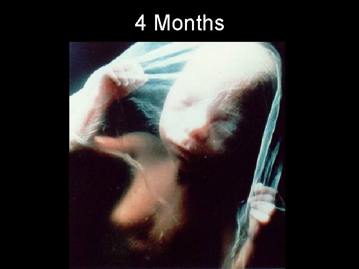 4 Months 
