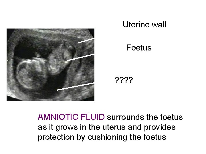 Uterine wall Foetus ? ? AMNIOTIC FLUID surrounds the foetus as it grows in