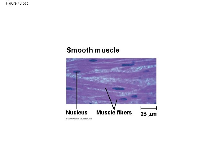 Figure 40. 5 cc Smooth muscle Nucleus Muscle fibers 25 m 