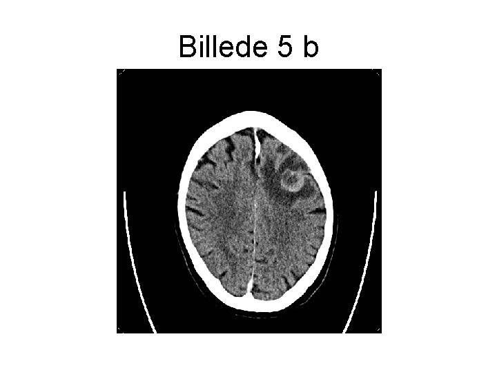 Billede 5 b 