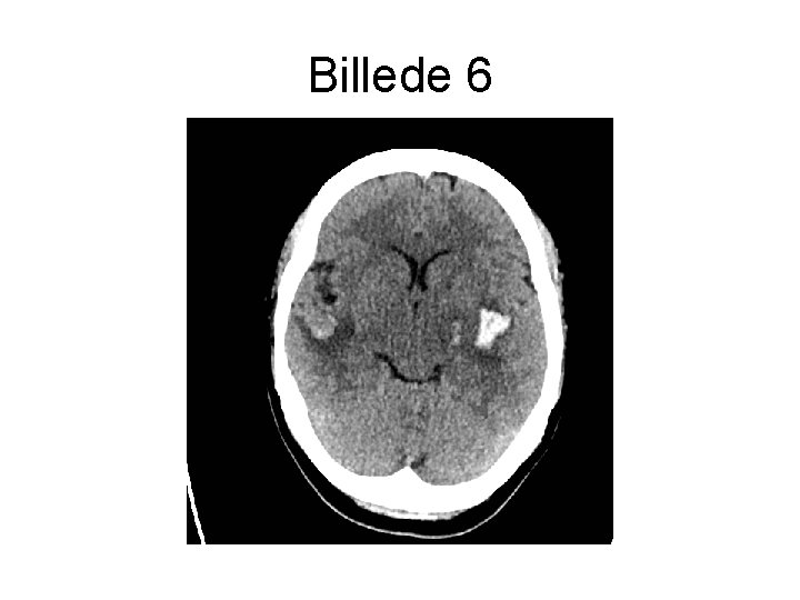 Billede 6 