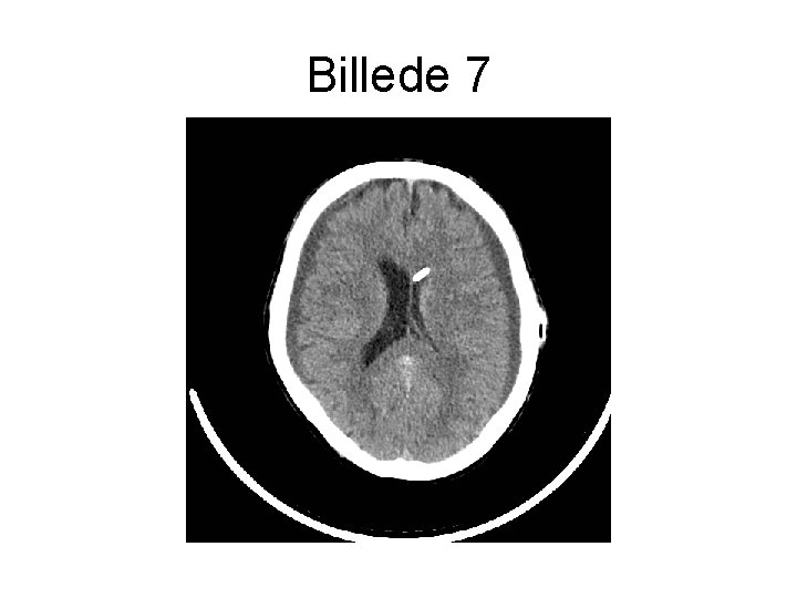 Billede 7 