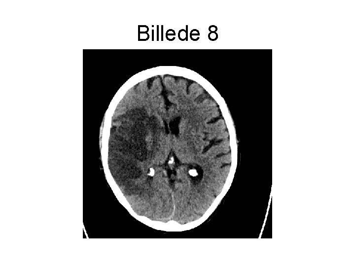 Billede 8 