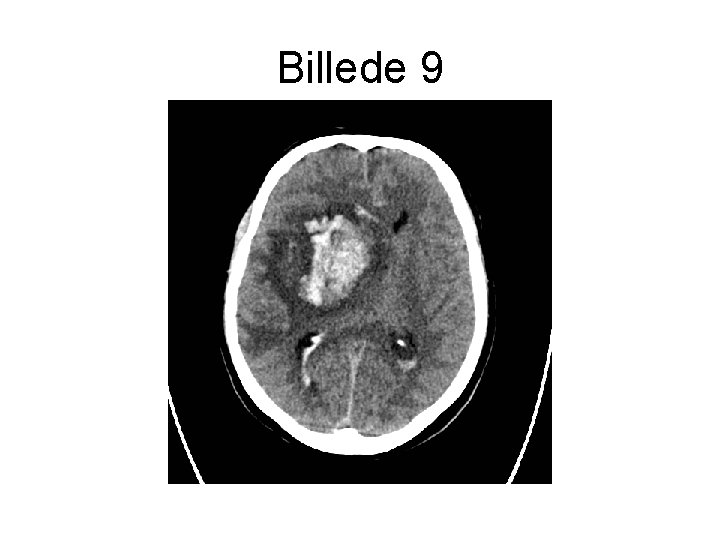 Billede 9 