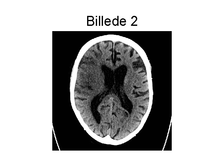 Billede 2 