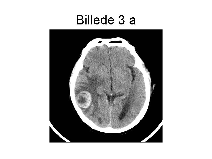 Billede 3 a 