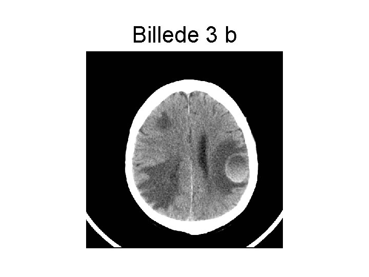 Billede 3 b 