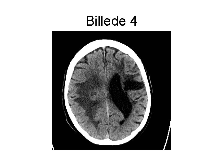 Billede 4 