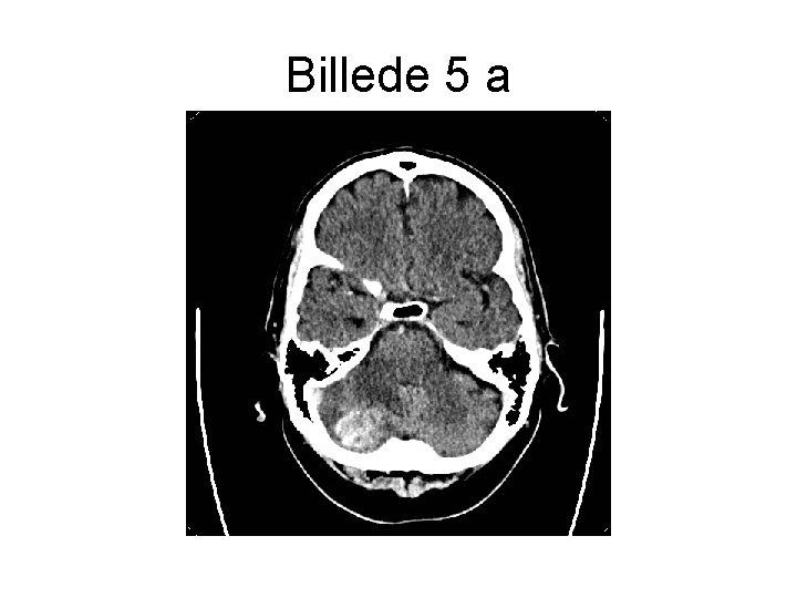 Billede 5 a 