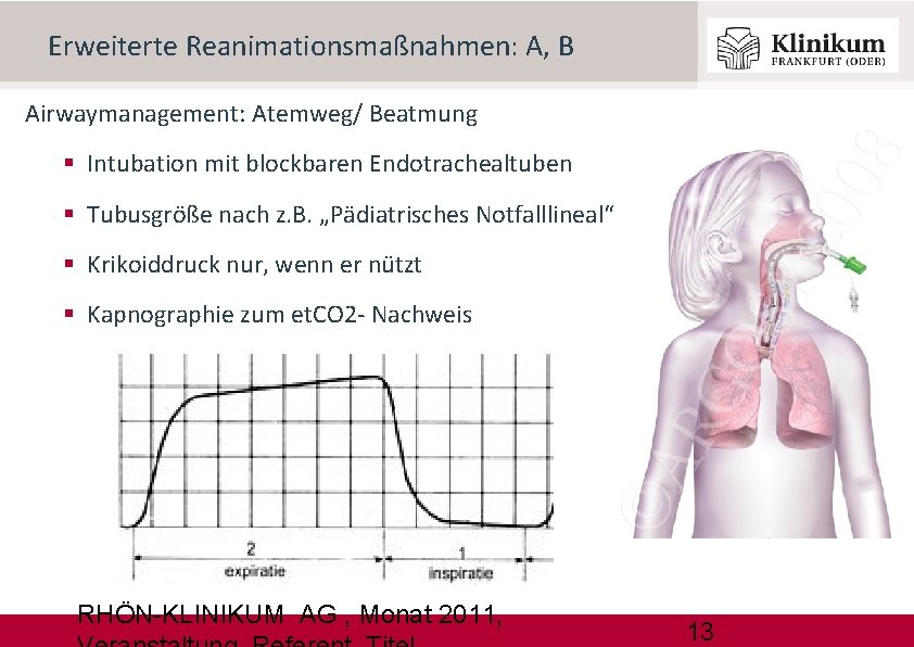Erweiterte Reanimationsmaßnahmen: A, B Airwaymanagement: Atemweg/ Beatmung Intubation mit blockbaren Endotrachealtuben Tubusgröße nach z.